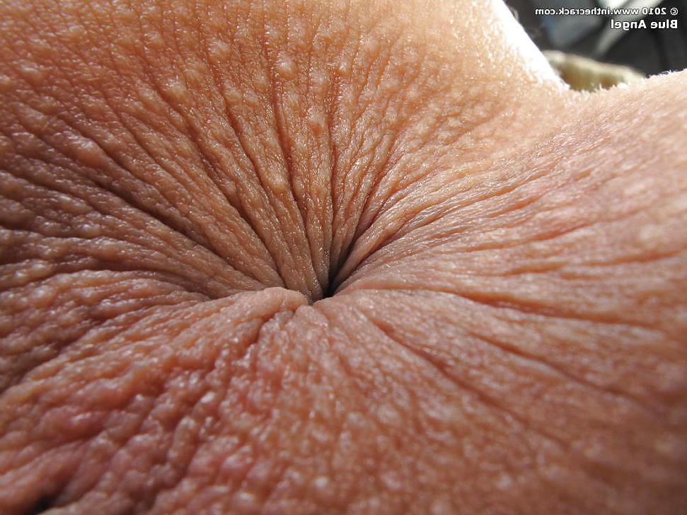 19P Asses en feet