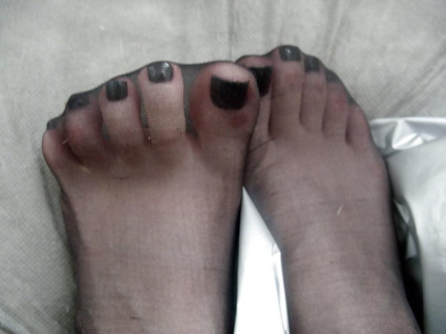 25P Nylon feet 33