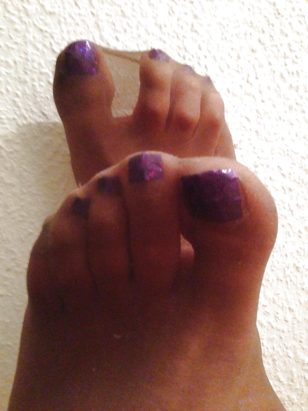 25P Nylon feet 33