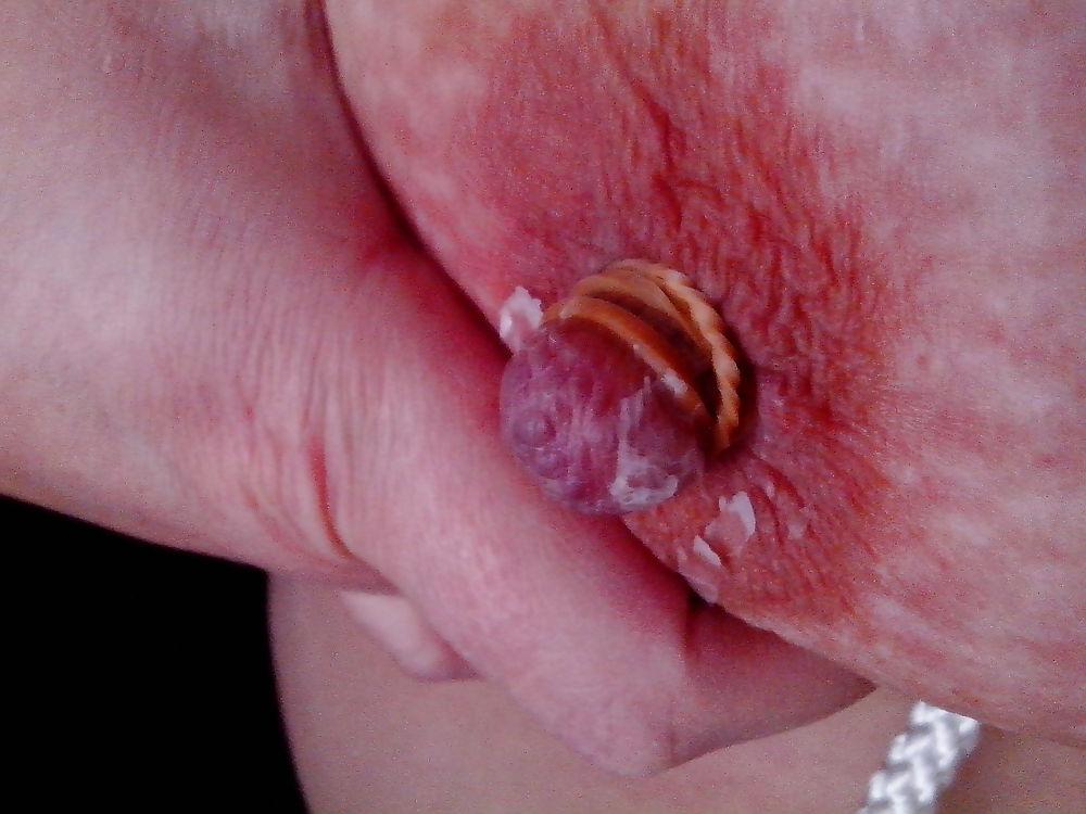 10P Boob torture