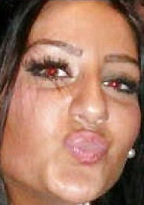 25P Albania Bitch XHILDA