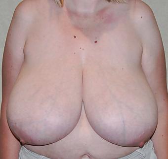 16P Huge natural amateur tits 5
