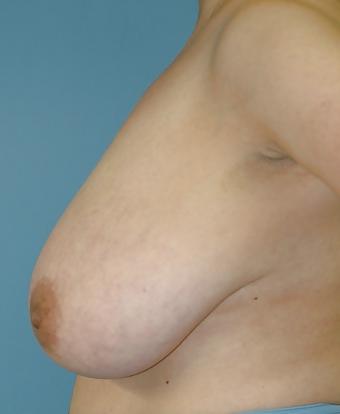16P Huge natural amateur tits 5