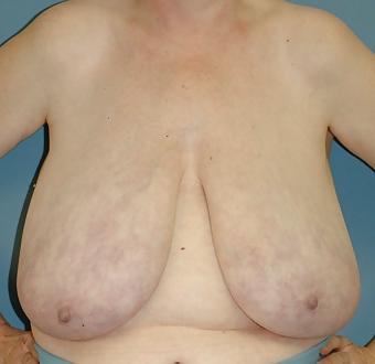 16P Huge natural amateur tits 5