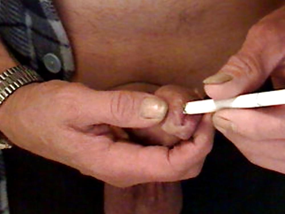 7P Cigarette burning