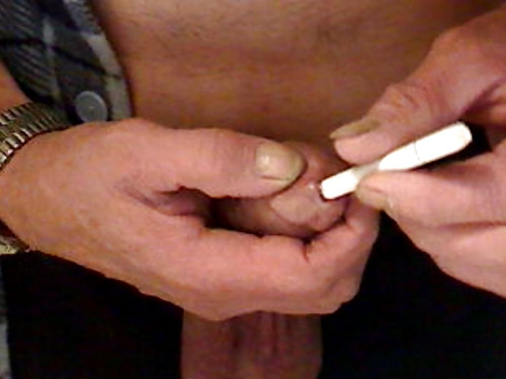 7P Cigarette burning