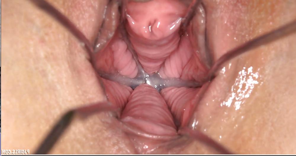 25P Female Genitals