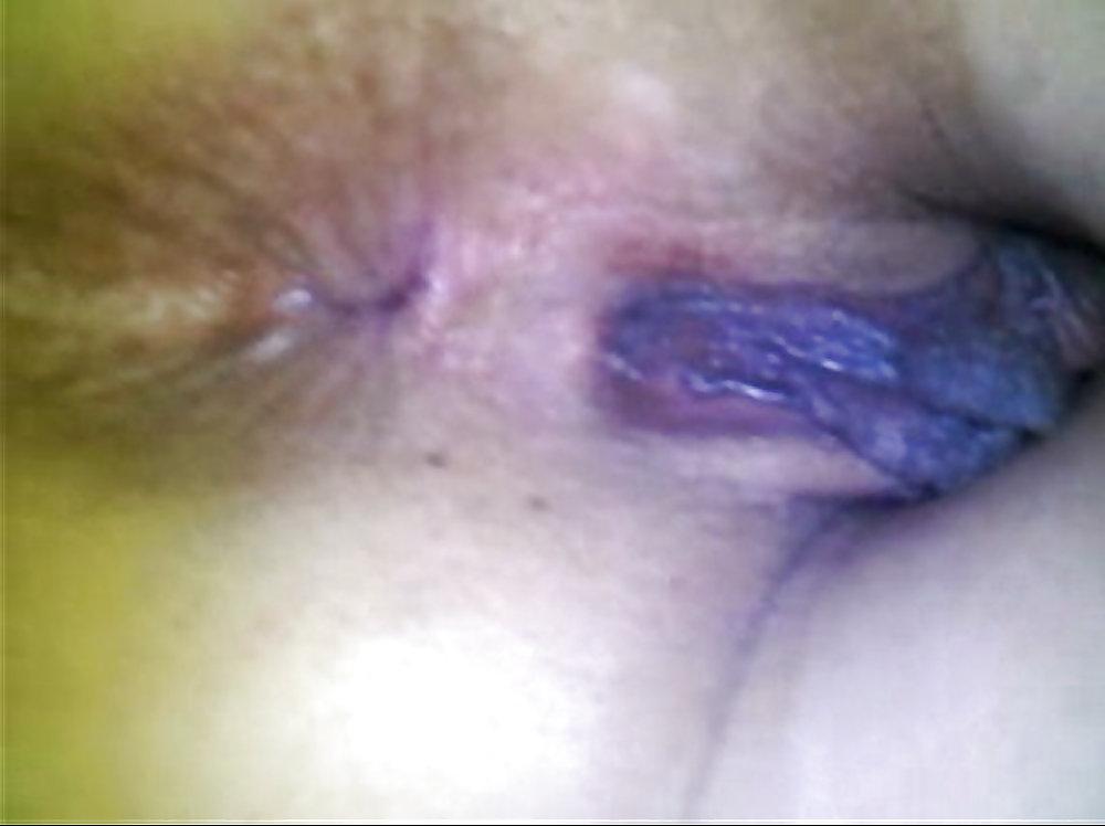 25P Big Juicy Labia