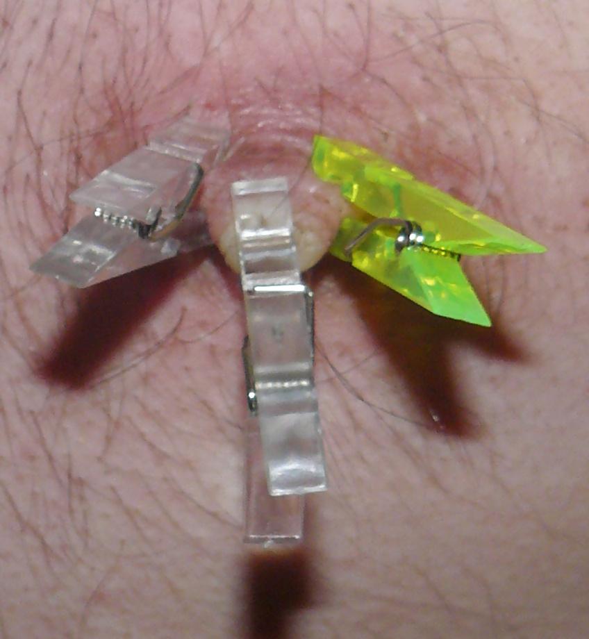 16P Tits torture