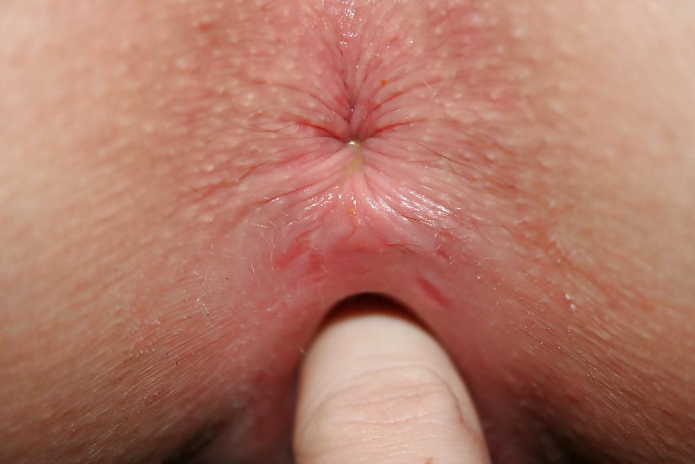 25P My anal queen