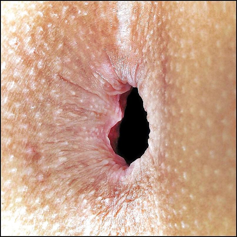 19P Hole in the bottom. Fantastic and welcoming abode female.