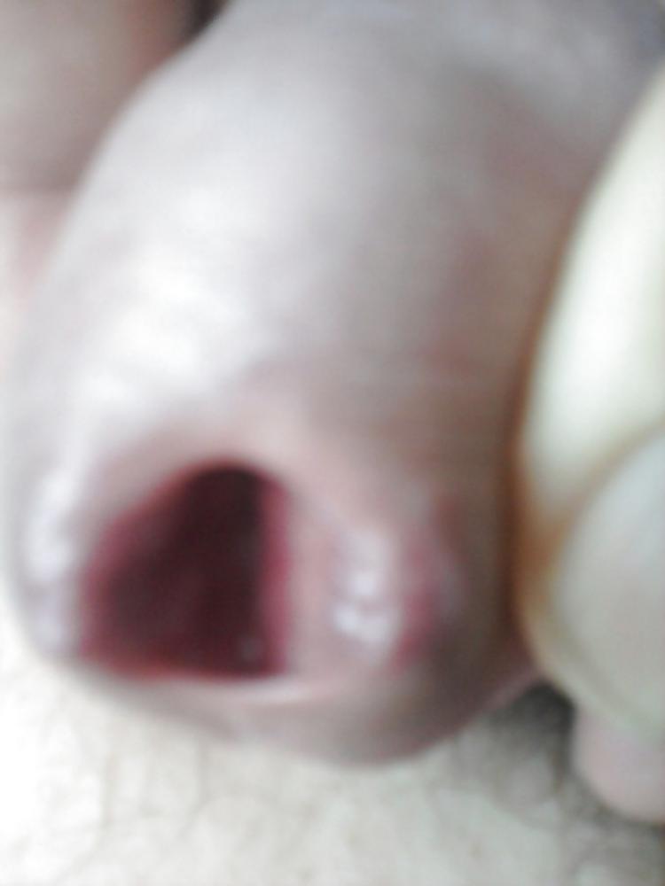 12P Urethral play sounding