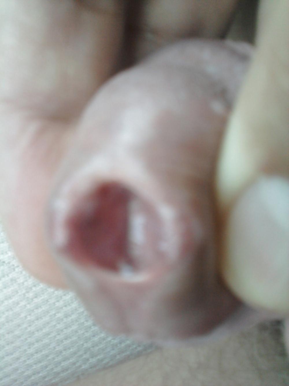 12P Urethral play sounding
