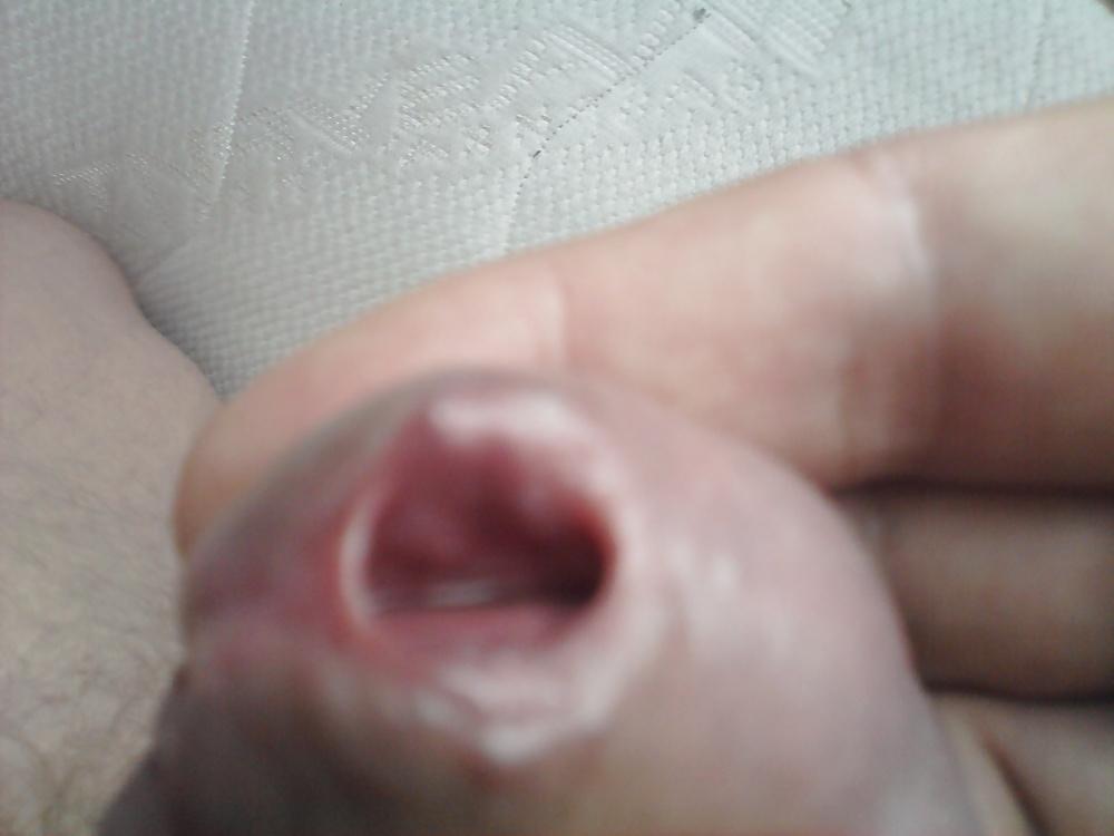 12P Urethral play sounding