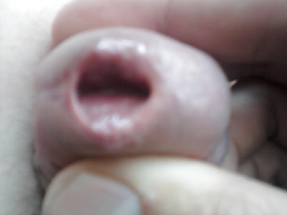 12P Urethral play sounding