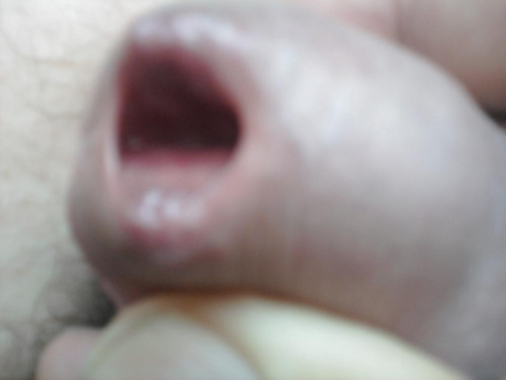 12P Urethral play sounding