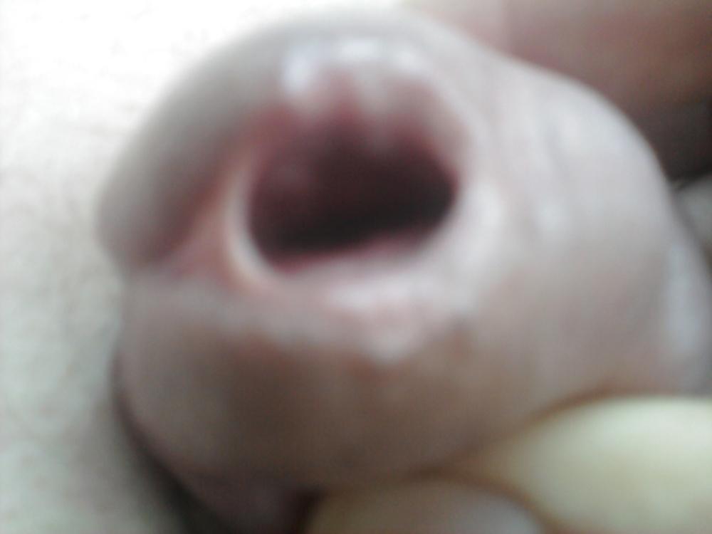 12P Urethral play sounding