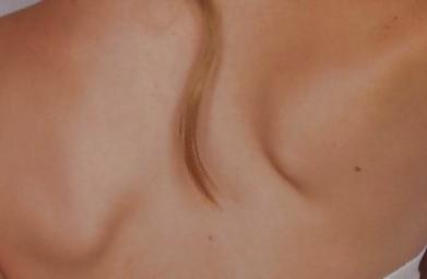 14P Female shoulder  