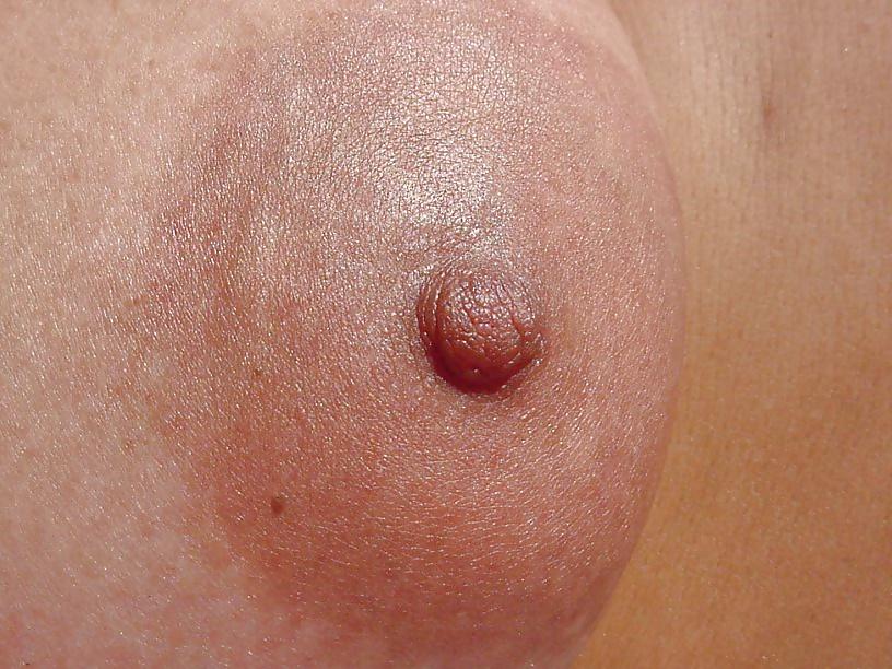 18P Meine Oben-ohne-Bilder
