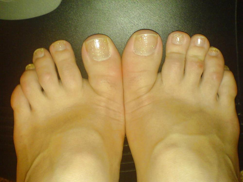 15P Feet and toes 2