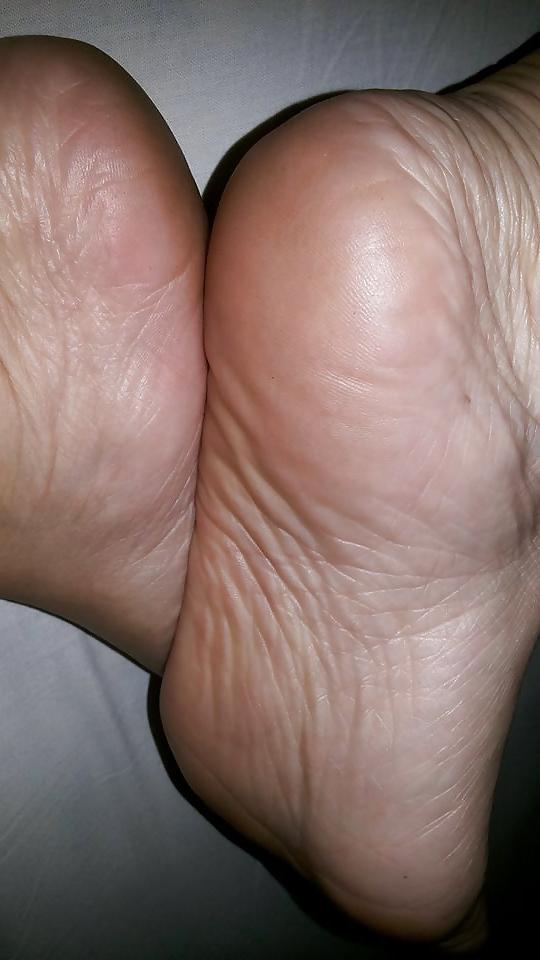 25P Feet Mature