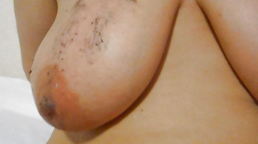 25P Burning tits cigarette
