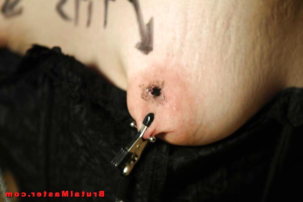 25P Burning tits cigarette