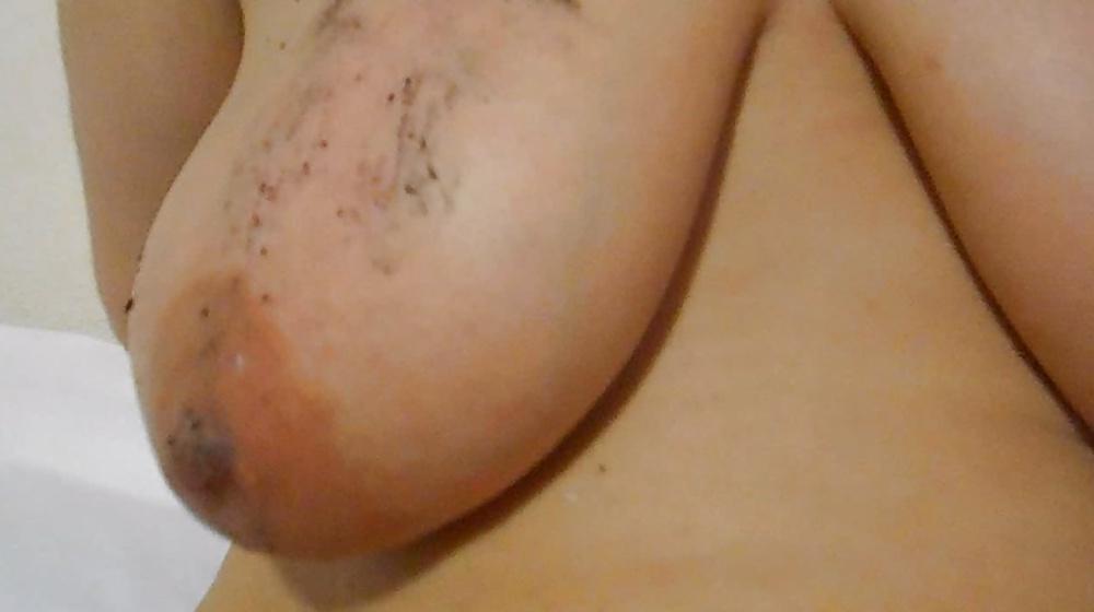 25P Burning tits cigarette