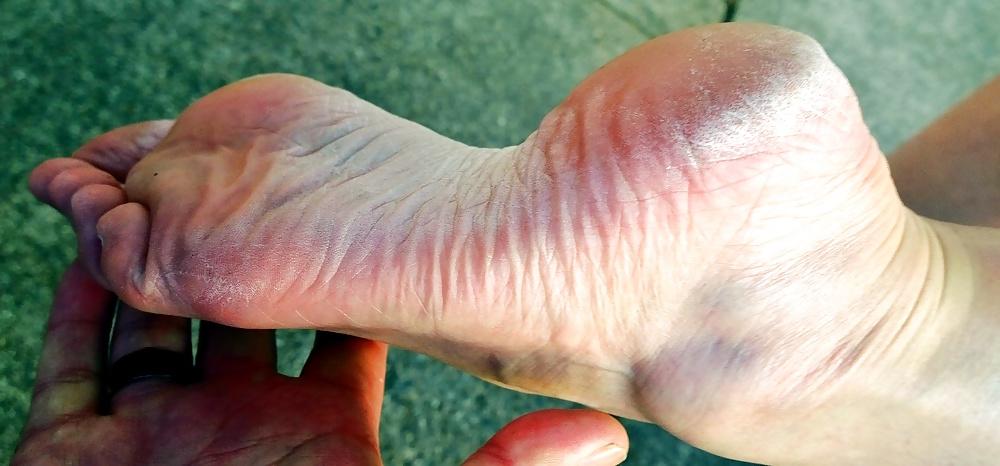 16P Rough feet 1