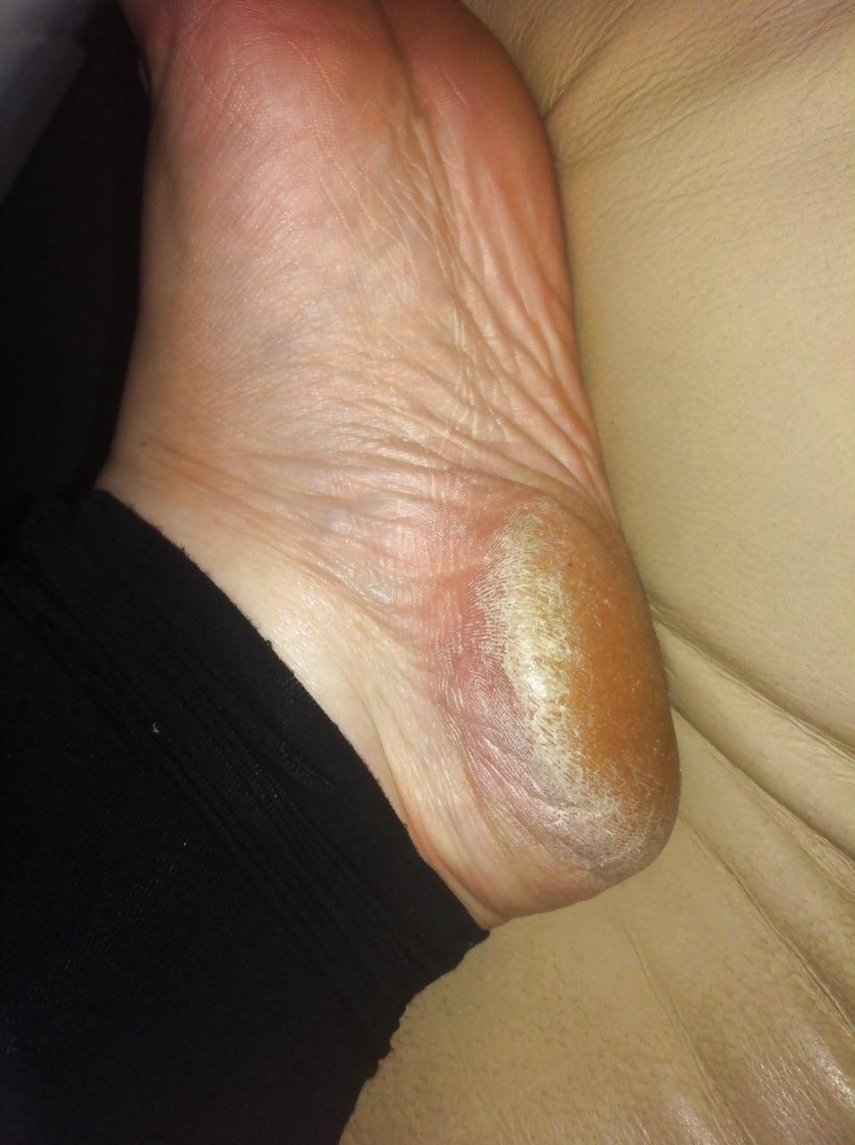25P Rough feet 2