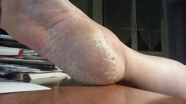 25P Rough feet 2