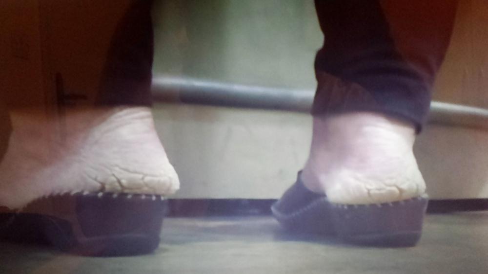 25P Rough feet 2