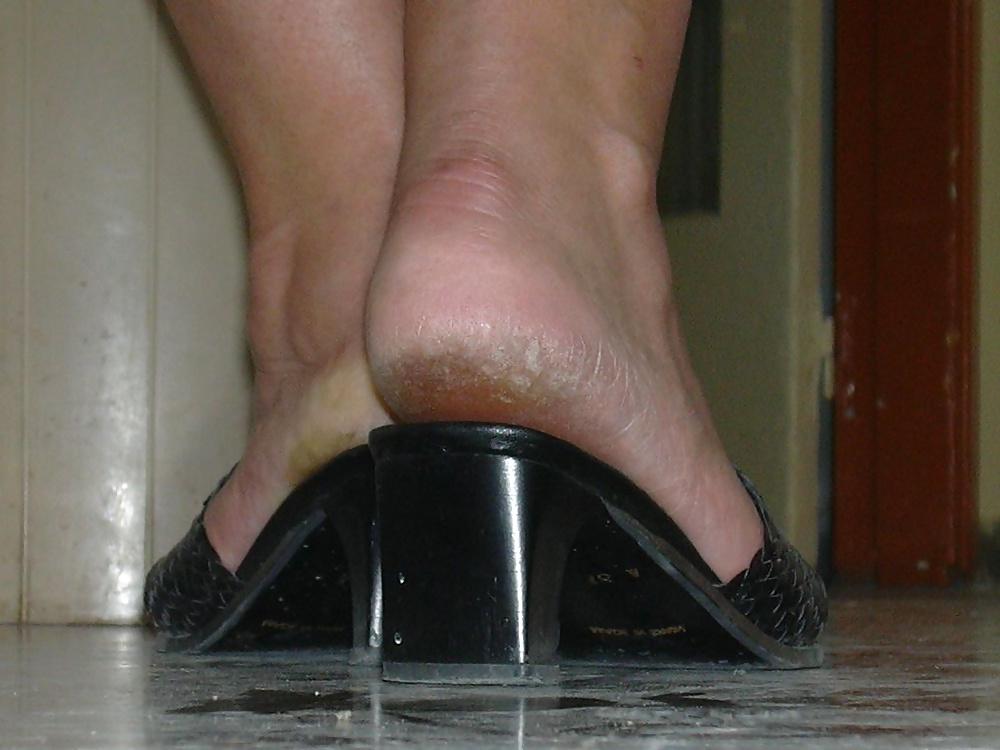 25P Rough feet 2