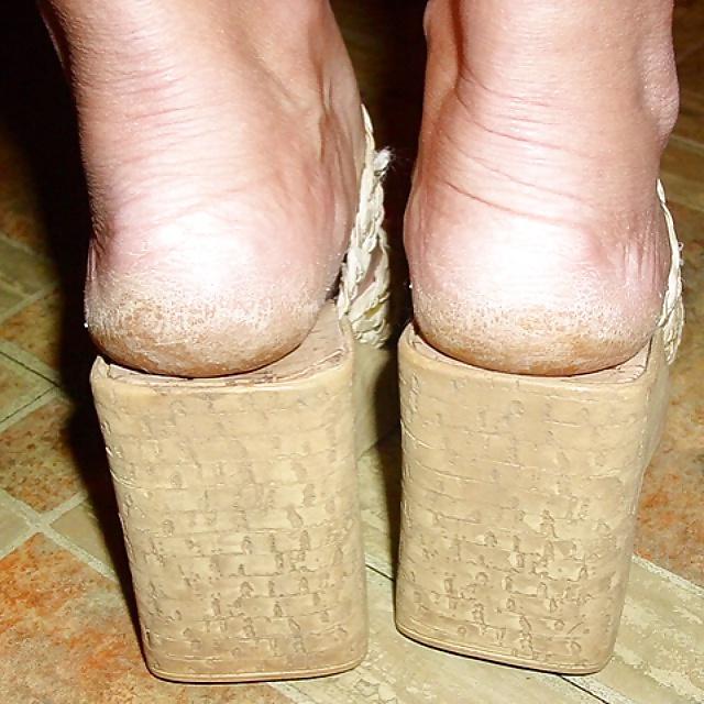 25P Rough feet 2