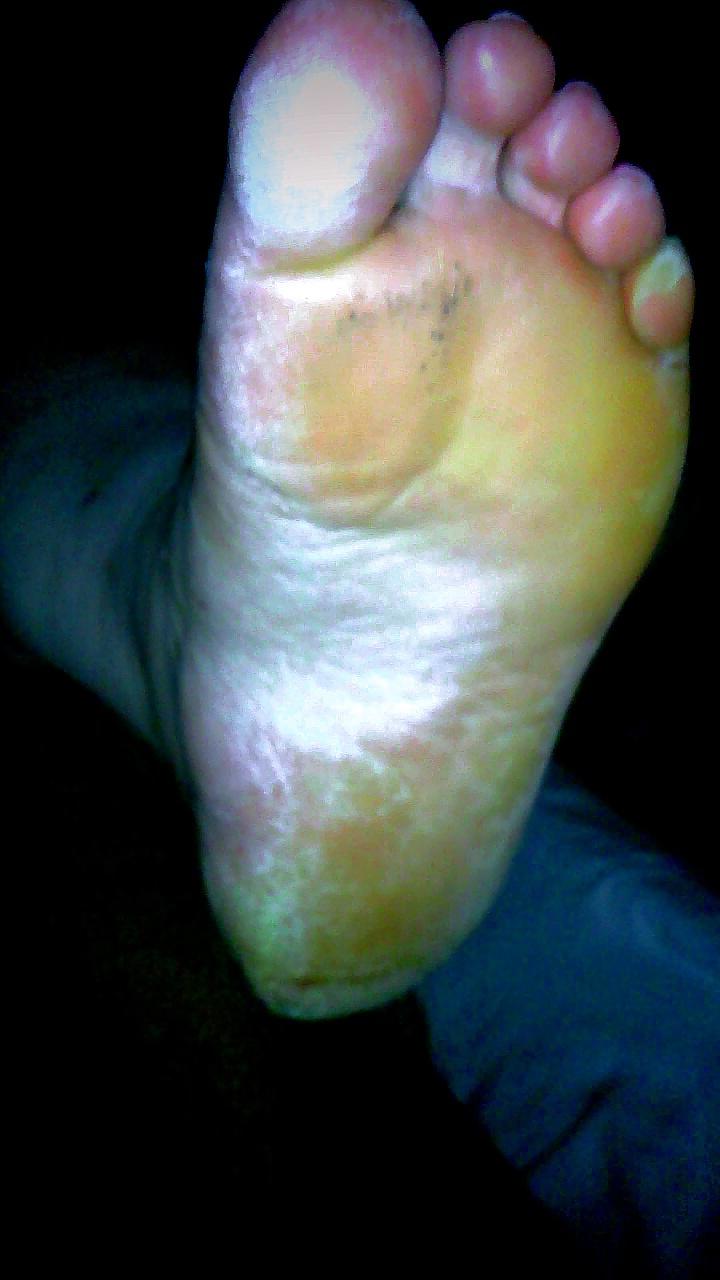 25P Rough feet 2