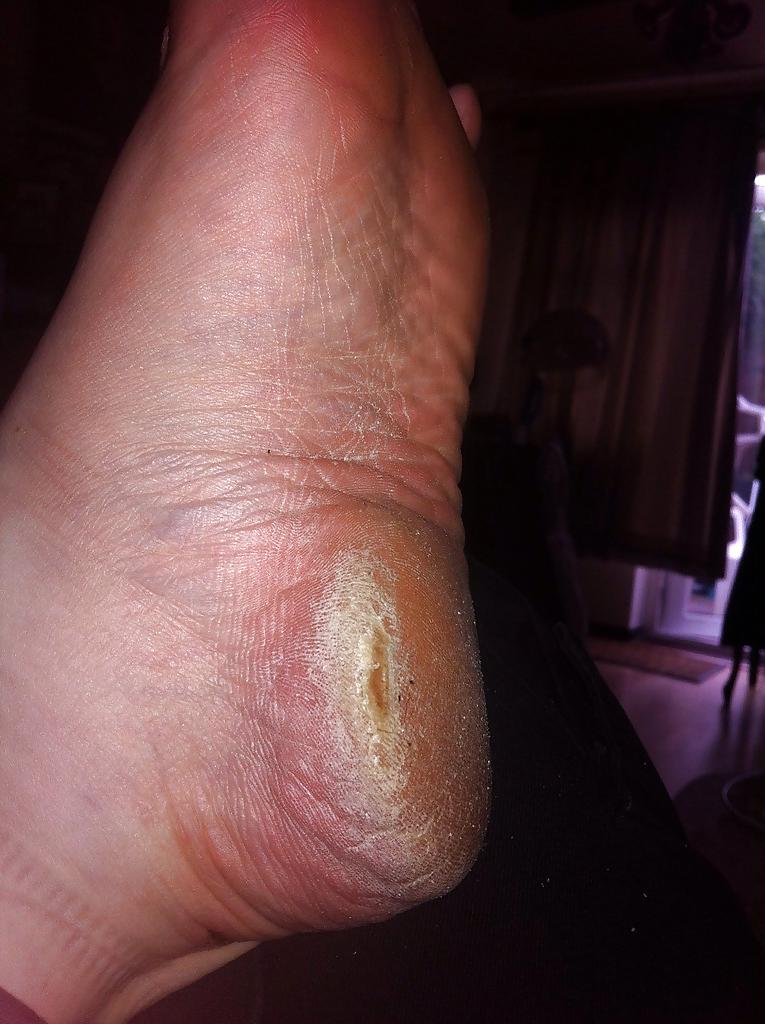 25P Rough feet 2