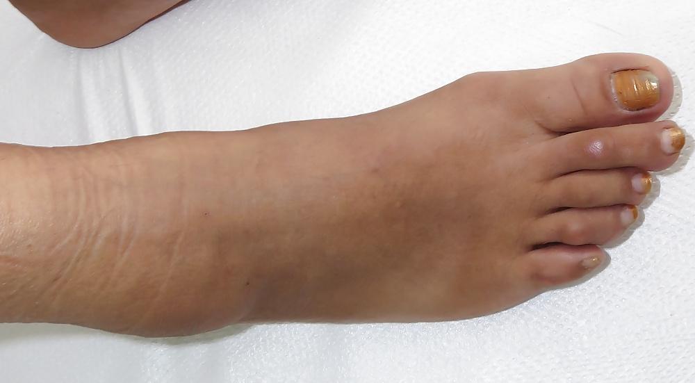 25P Female friend's feet