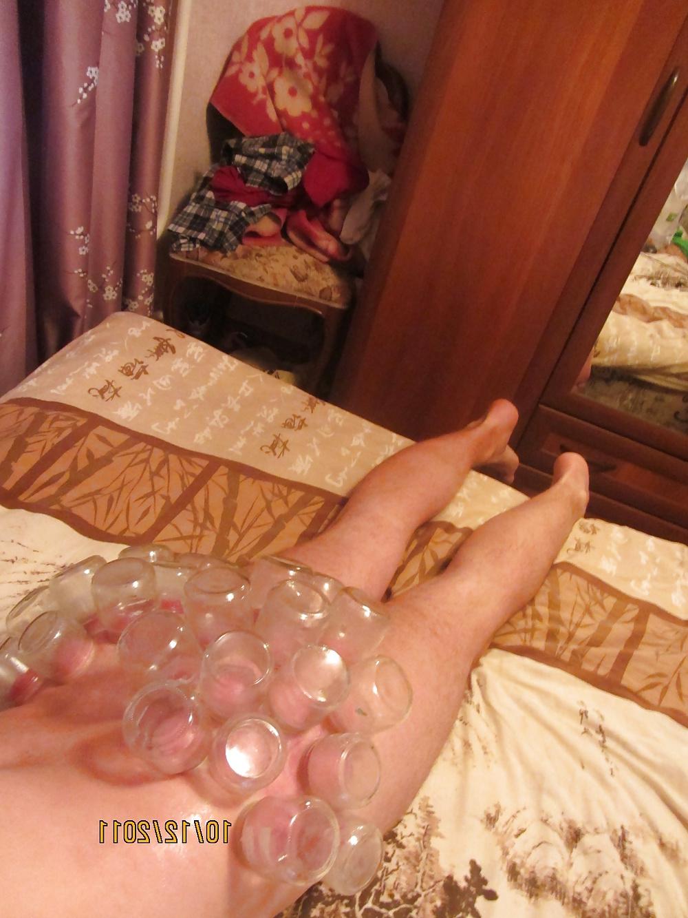 11P Vacuum (fire cupping) ass torture