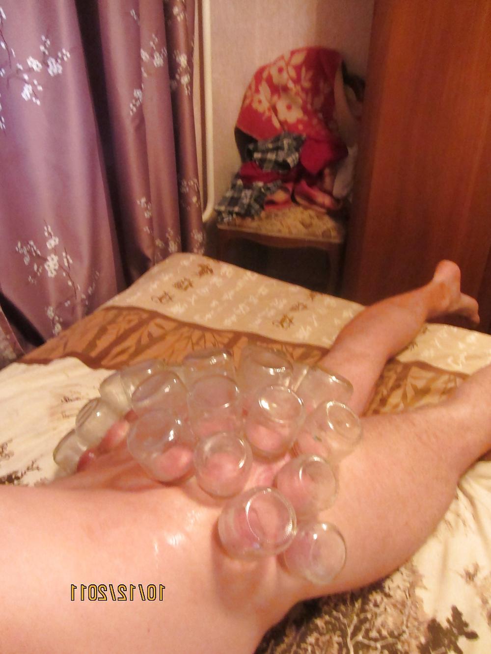 11P Vacuum (fire cupping) ass torture