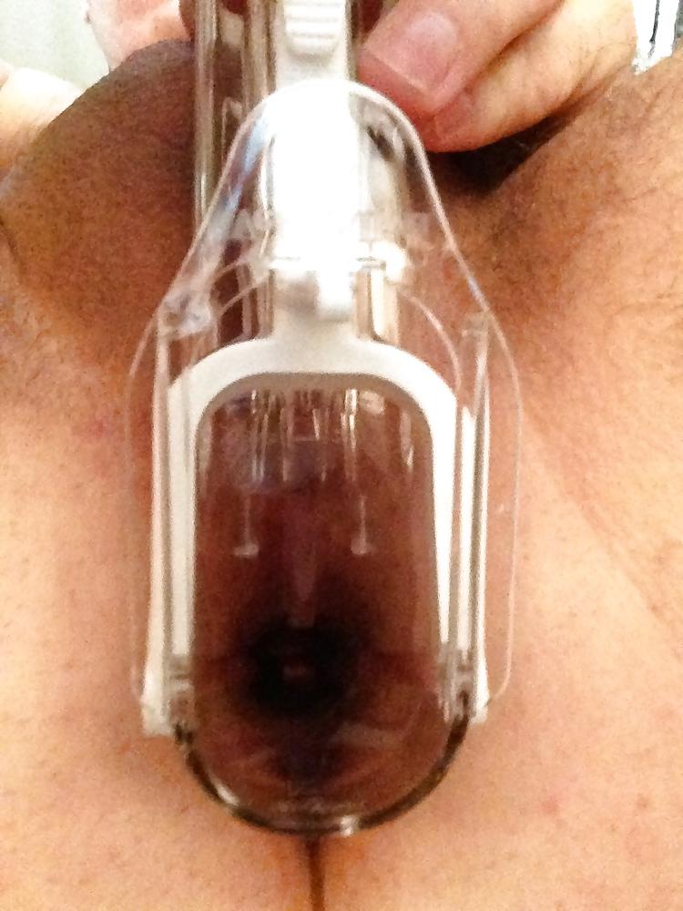 6P Speculum Play