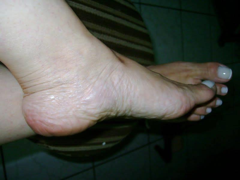 24P Feet Mature
