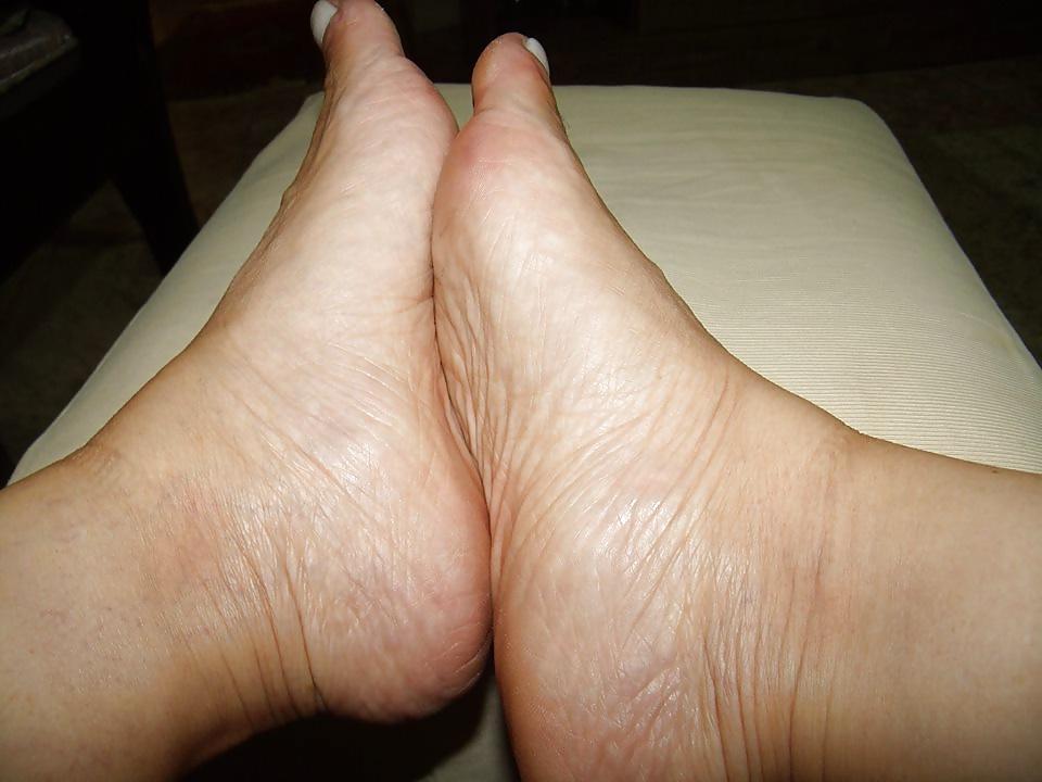 24P Feet Mature