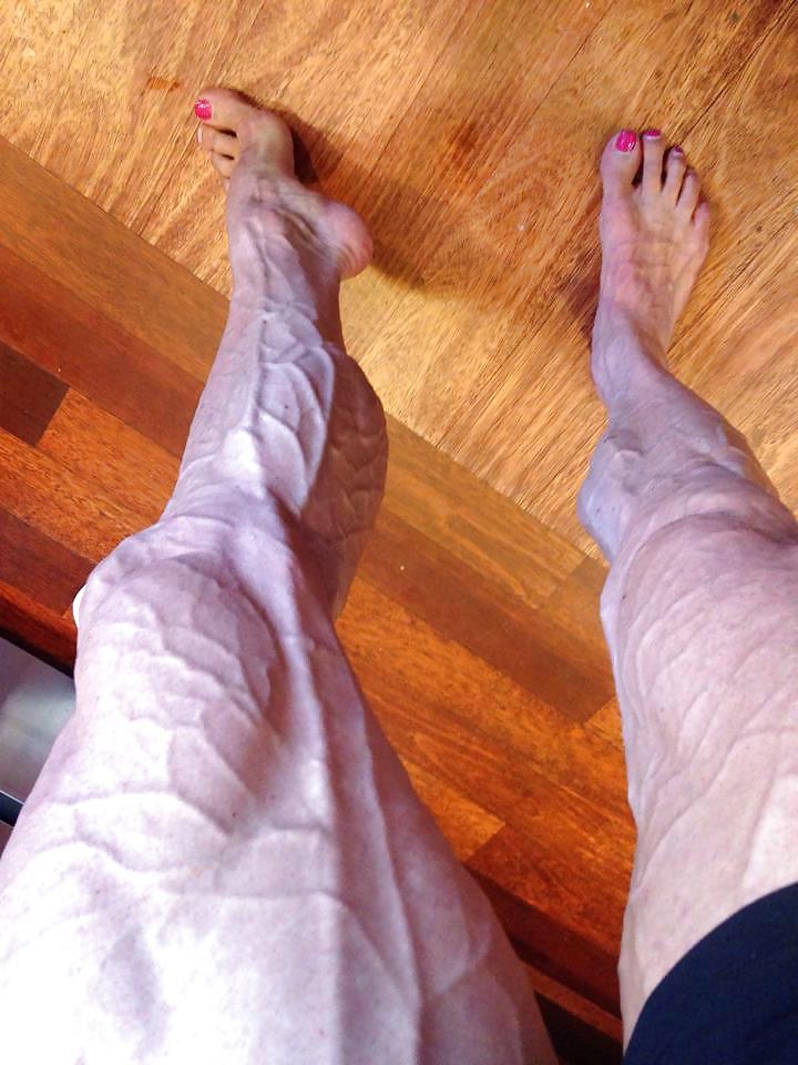 25P Veiny muscular female legs