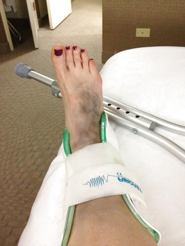 25P Beth Phoenix Feet