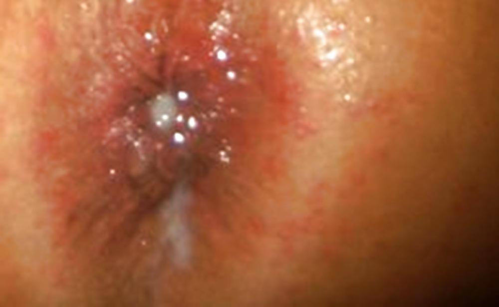 12P BBC Bull Tearing Up My Ass Pussy and Fillin It Up With Cum