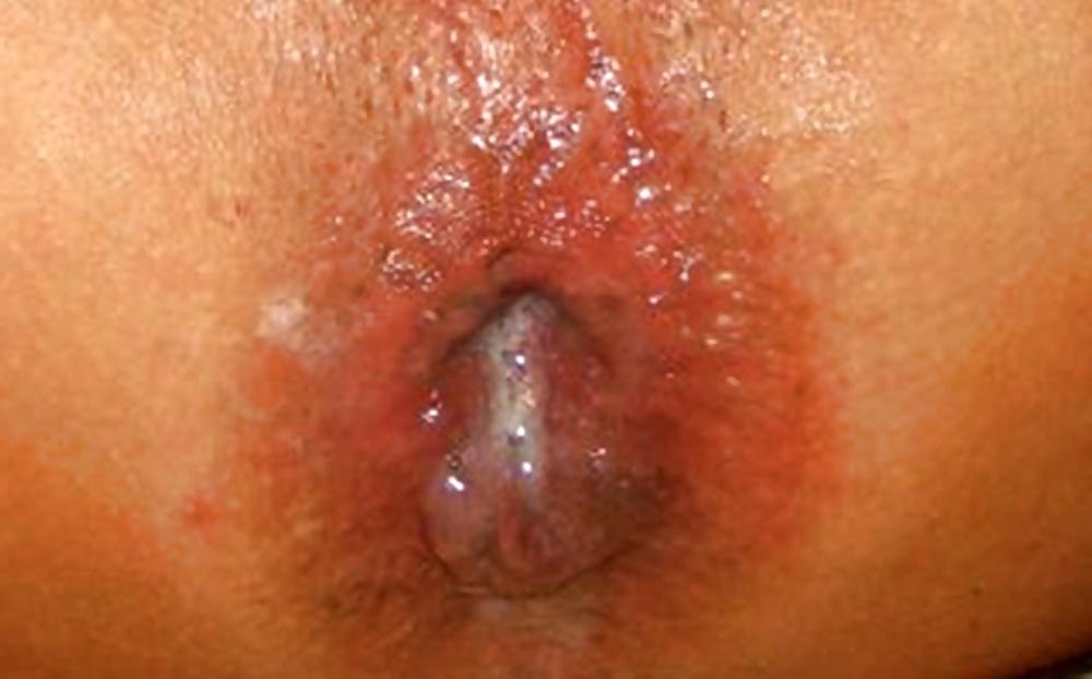 12P BBC Bull Tearing Up My Ass Pussy and Fillin It Up With Cum