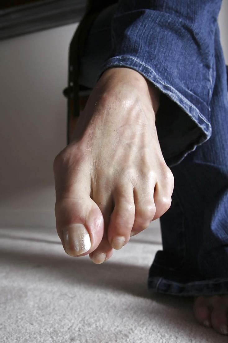 25P Mature feet and toenails