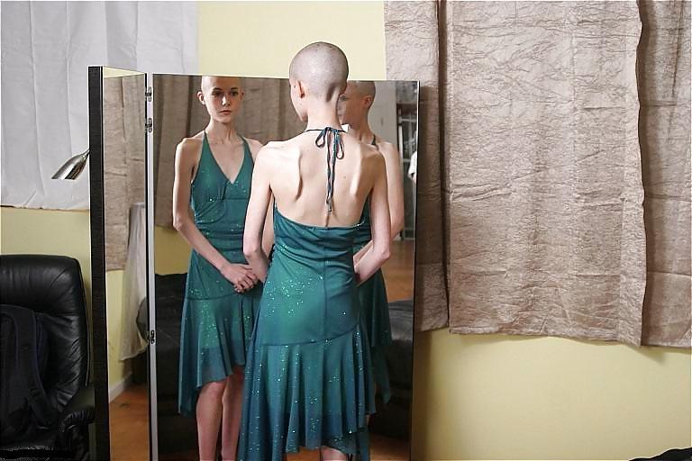 25P Tiny tit, shaved, bald, cute