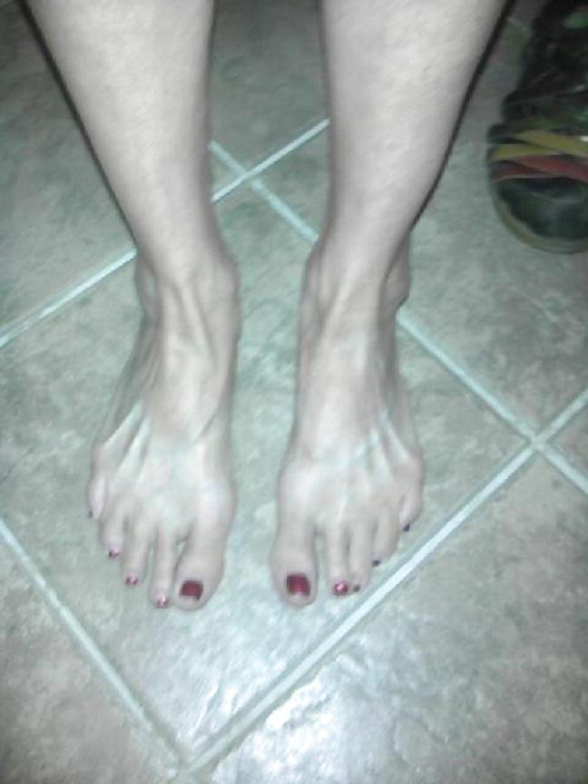 25P MATURE FEET AND SHOES