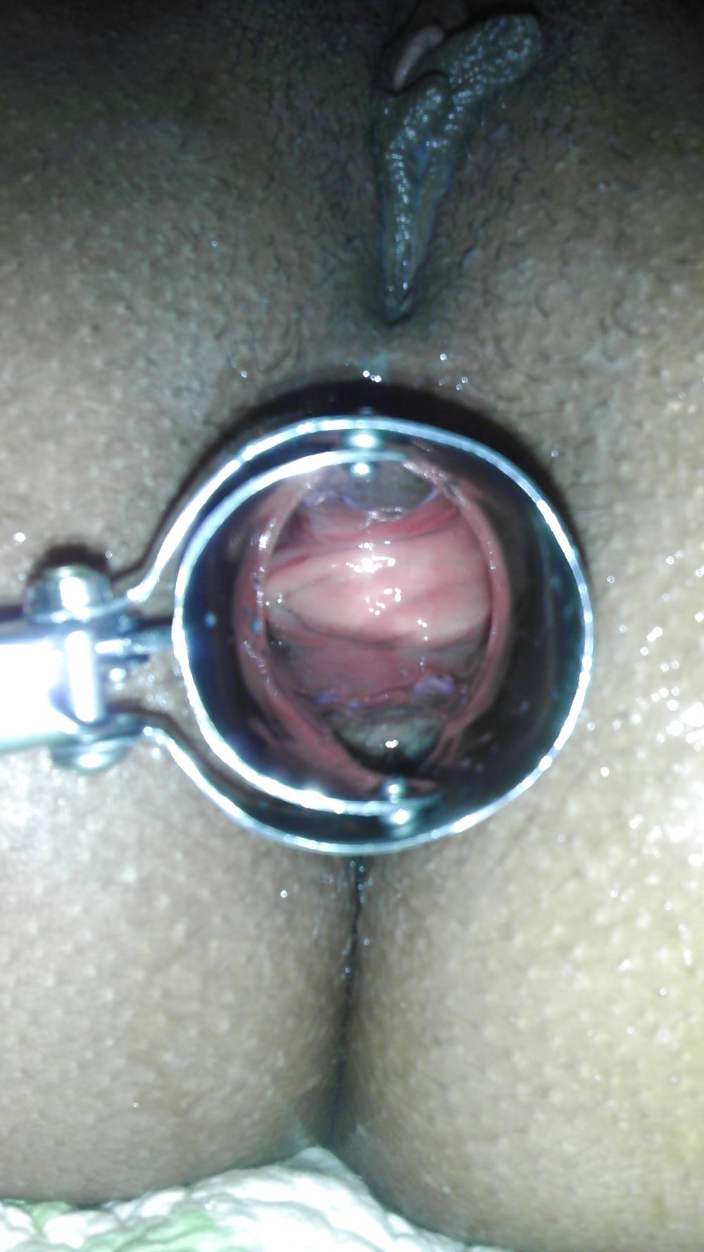 8P Girlfriend gaping speculum play